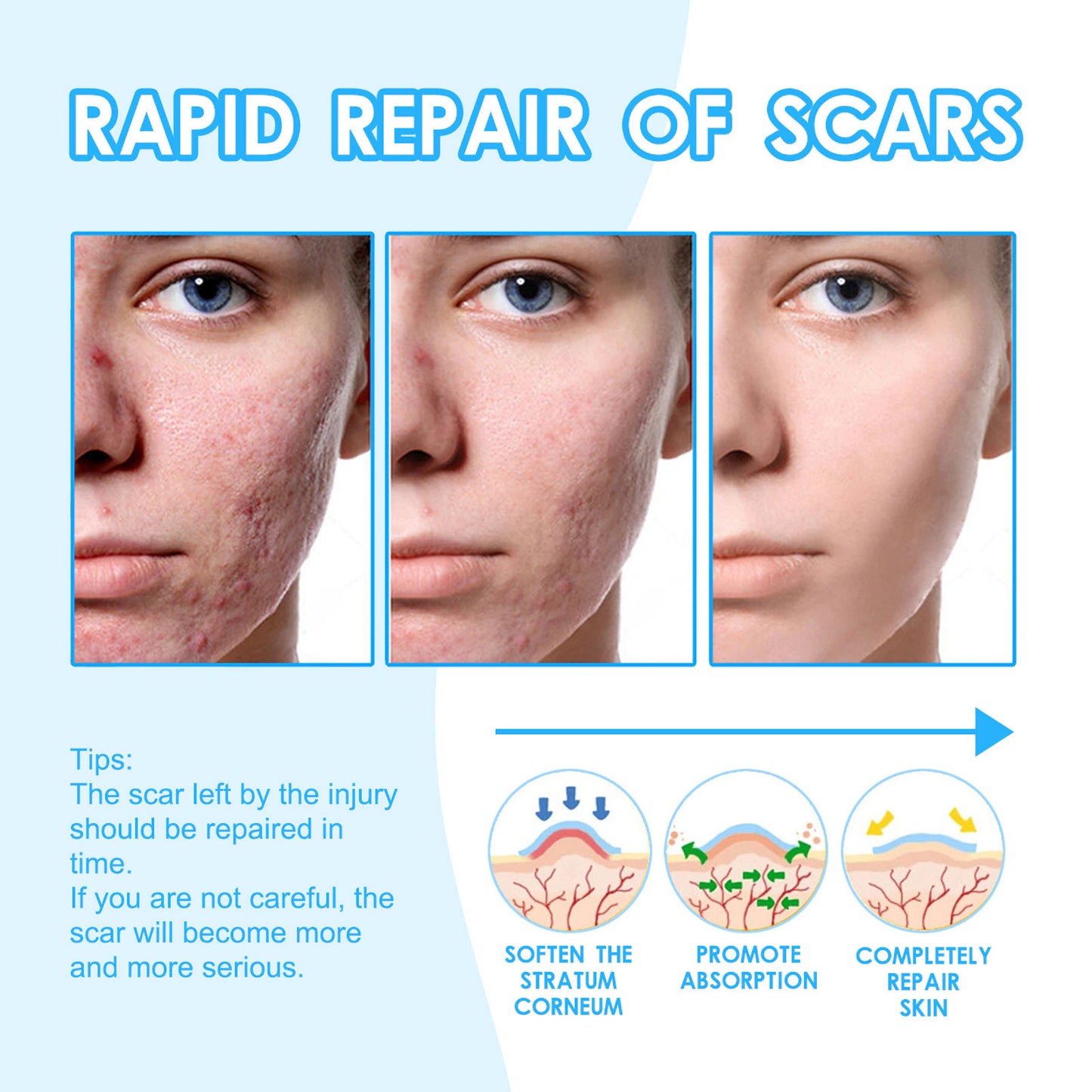 Scar cream l Special treatment for perennial scars, keloid scars, pitted scars
