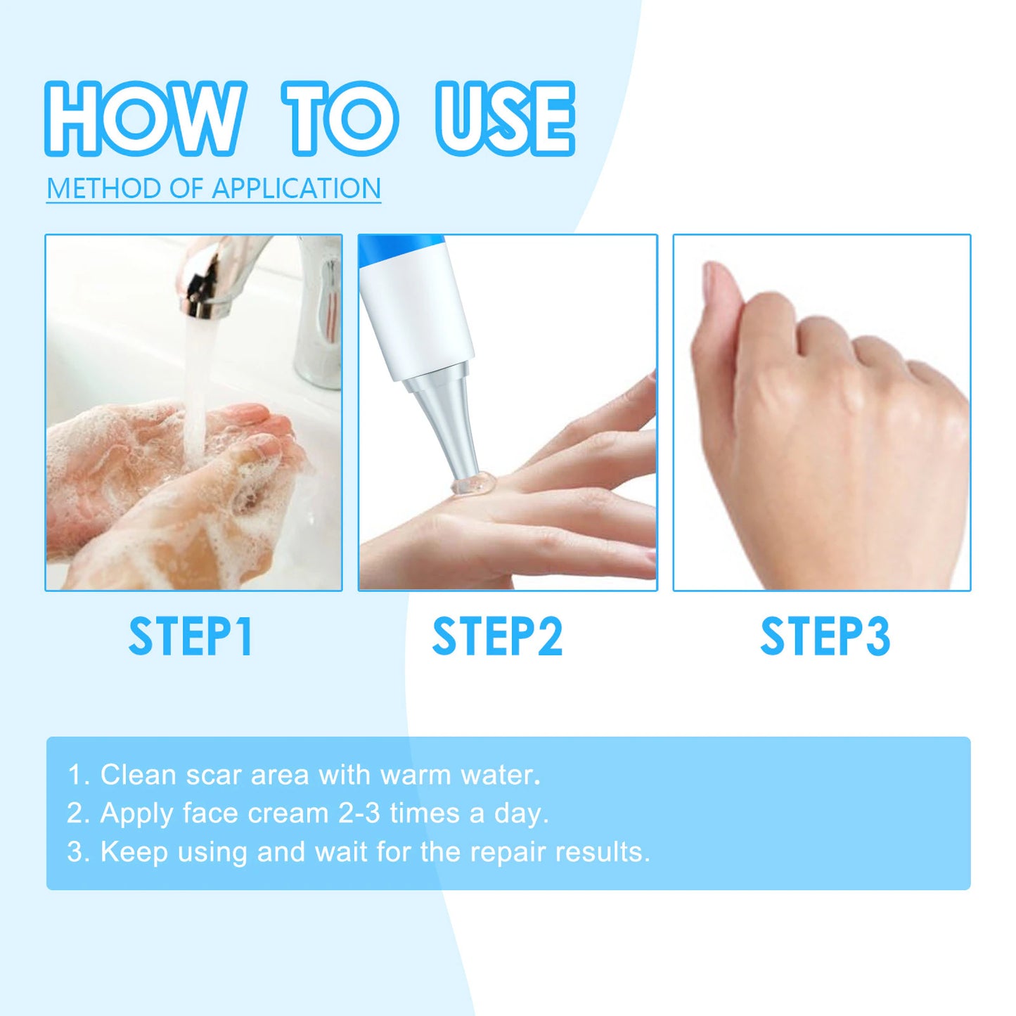Scar cream l Special treatment for perennial scars, keloid scars, pitted scars