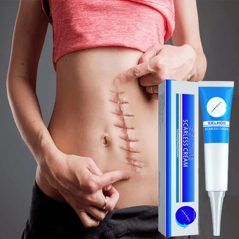 Scar cream l Special treatment for perennial scars, keloid scars, pitted scars