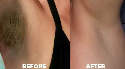 BELLEZON™ Body Care Brightening Cream
