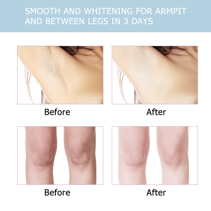 BELLEZON™ Body Care Brightening Cream