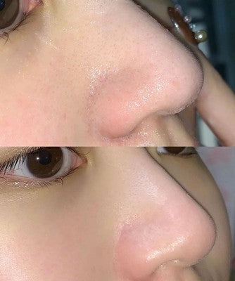 Green Tea Skin Regenerating Mask