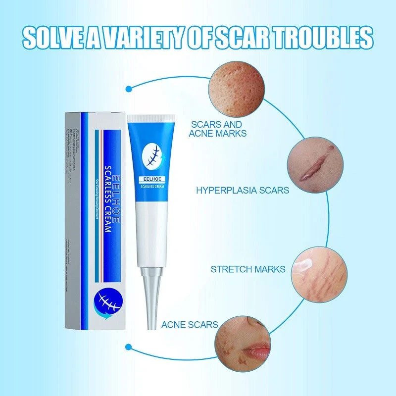 Scar cream l Special treatment for perennial scars, keloid scars, pitted scars