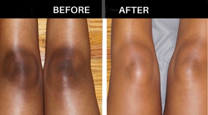 BELLEZON™ Body Care Brightening Cream