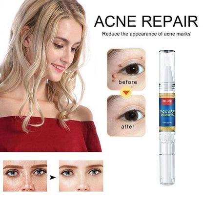 Wart Removal Pen l Return you white skin quickly