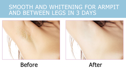 BELLEZON™ Body Care Brightening Cream